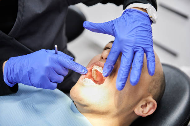 Best Emergency Denture Repair in North Ridgeville, OH